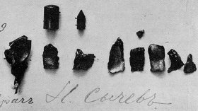 Fragments of an explosive bullet extracted from the wound of a soldier in 1914