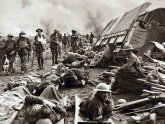 World War One injuries